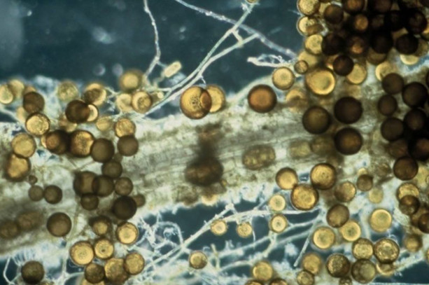 Raíz micorrizada y esporas del hongo